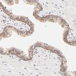 PTK7 Antibody in Immunohistochemistry (Paraffin) (IHC (P))