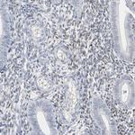 MiTF Antibody in Immunohistochemistry (Paraffin) (IHC (P))