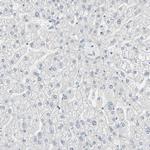 MiTF Antibody in Immunohistochemistry (Paraffin) (IHC (P))