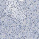 MiTF Antibody in Immunohistochemistry (Paraffin) (IHC (P))