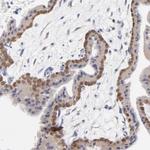 MKP4 Antibody in Immunohistochemistry (Paraffin) (IHC (P))