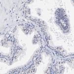 MKP4 Antibody in Immunohistochemistry (Paraffin) (IHC (P))