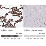 S100A10 Antibody