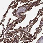 S100A10 Antibody in Immunohistochemistry (Paraffin) (IHC (P))