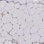 S100A10 Antibody in Immunohistochemistry (Paraffin) (IHC (P))