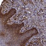 S100A10 Antibody in Immunohistochemistry (Paraffin) (IHC (P))