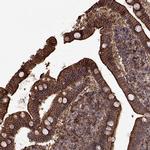 S100A10 Antibody in Immunohistochemistry (Paraffin) (IHC (P))