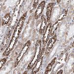 MAD2 Antibody in Immunohistochemistry (Paraffin) (IHC (P))