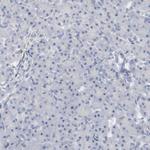 CDK1 Antibody in Immunohistochemistry (Paraffin) (IHC (P))