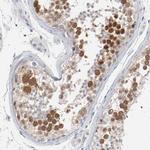 CDK1 Antibody in Immunohistochemistry (Paraffin) (IHC (P))