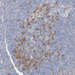 CDK1 Antibody in Immunohistochemistry (Paraffin) (IHC (P))