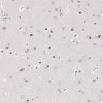 ZEB2 Antibody in Immunohistochemistry (Paraffin) (IHC (P))