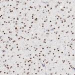 ZEB2 Antibody in Immunohistochemistry (Paraffin) (IHC (P))