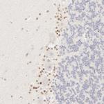 Nkx2.2 Antibody in Immunohistochemistry (Paraffin) (IHC (P))