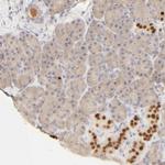 Nkx2.2 Antibody in Immunohistochemistry (Paraffin) (IHC (P))