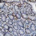 LCK Antibody in Immunohistochemistry (Paraffin) (IHC (P))