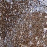 LCK Antibody in Immunohistochemistry (Paraffin) (IHC (P))