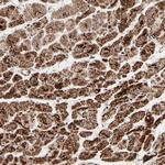 UQCRC1 Antibody in Immunohistochemistry (Paraffin) (IHC (P))