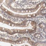 CD123 Antibody in Immunohistochemistry (Paraffin) (IHC (P))