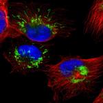 SETD3 Antibody in Immunocytochemistry (ICC/IF)