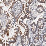 SETD3 Antibody in Immunohistochemistry (Paraffin) (IHC (P))