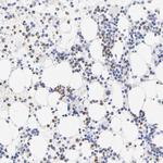 Arginase 1 Antibody in Immunohistochemistry (Paraffin) (IHC (P))