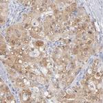 Arginase 1 Antibody in Immunohistochemistry (Paraffin) (IHC (P))