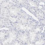 Arginase 1 Antibody in Immunohistochemistry (Paraffin) (IHC (P))