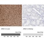 Arginase 1 Antibody