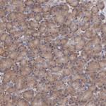 EB1 Antibody in Immunohistochemistry (Paraffin) (IHC (P))