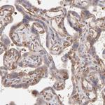 EB1 Antibody in Immunohistochemistry (Paraffin) (IHC (P))