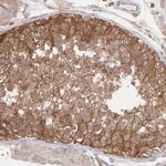 EB1 Antibody in Immunohistochemistry (Paraffin) (IHC (P))