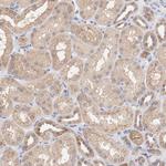 SETD3 Antibody in Immunohistochemistry (Paraffin) (IHC (P))