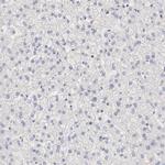 SETD3 Antibody in Immunohistochemistry (Paraffin) (IHC (P))