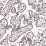 SETD3 Antibody in Immunohistochemistry (Paraffin) (IHC (P))