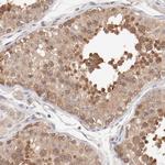 SETD3 Antibody in Immunohistochemistry (Paraffin) (IHC (P))