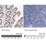 TST Antibody