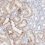 TST Antibody in Immunohistochemistry (Paraffin) (IHC (P))