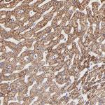 TST Antibody in Immunohistochemistry (Paraffin) (IHC (P))