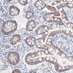 TST Antibody in Immunohistochemistry (Paraffin) (IHC (P))