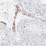 TST Antibody in Immunohistochemistry (Paraffin) (IHC (P))