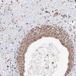 OAS1 Antibody in Immunohistochemistry (Paraffin) (IHC (P))