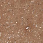 CD90 Antibody in Immunohistochemistry (Paraffin) (IHC (P))