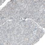 CD90 Antibody in Immunohistochemistry (Paraffin) (IHC (P))