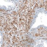 CD90 Antibody in Immunohistochemistry (Paraffin) (IHC (P))