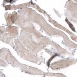 CD90 Antibody in Immunohistochemistry (Paraffin) (IHC (P))