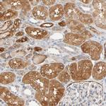 BIN1 Antibody in Immunohistochemistry (Paraffin) (IHC (P))