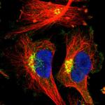 EPS8 Antibody in Immunocytochemistry (ICC/IF)