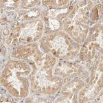 EPS8 Antibody in Immunohistochemistry (Paraffin) (IHC (P))