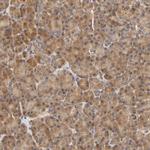 EPS8 Antibody in Immunohistochemistry (Paraffin) (IHC (P))